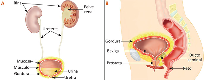 infográfico-câncer-de-bexiga